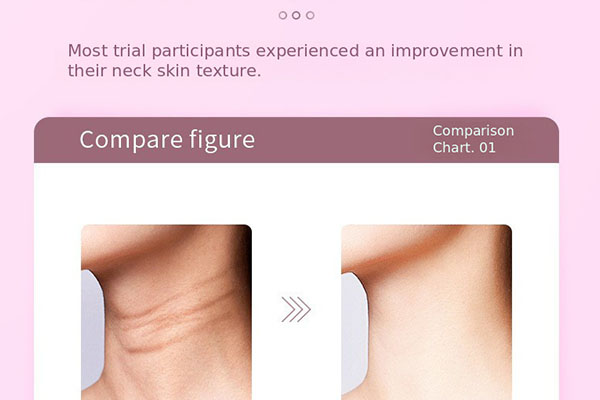 A diagram showing the different layers of the skin and how a neck beauty device works